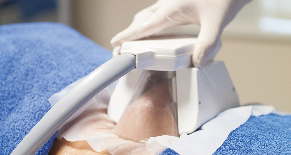 How Fat Freezing and HIFU Work Together? 2 Multiple Areas in One Session HIFU and Fat Freezing Harwich