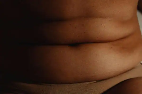 The Hidden Connection: How Stress Shapes Your Fitness and Body Composition 3 image of what stress can do on the stomach area and how Lipo 360 Harwich can help to change your body shape.